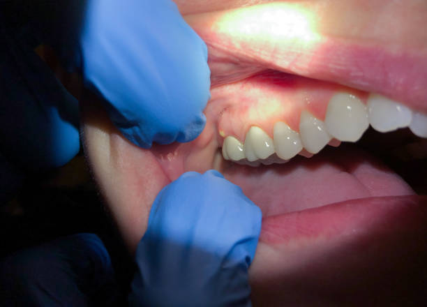 Best Emergency Root Canal Treatment in Concord, MO