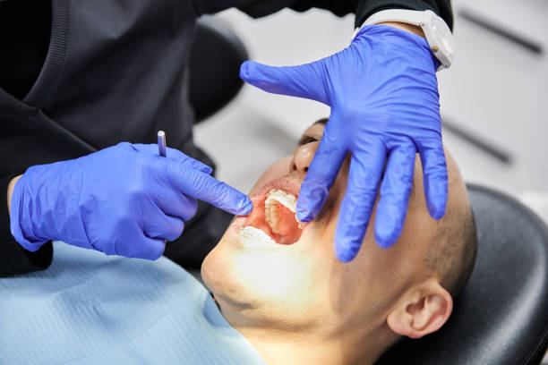 Best Emergency Tooth Extraction in Concord, MO